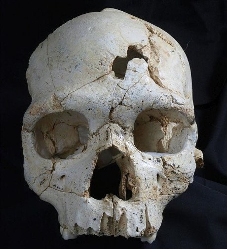 Das älteste bekannte Mordopfer