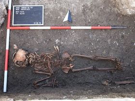 Kam die Syphilis doch nicht aus Amerika?