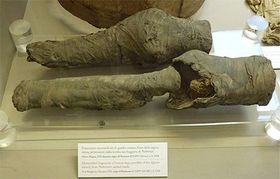 Knie der Gemahlin Ramses' II. entdeckt