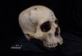 Krebsbehandlung im alten Ägypten?